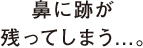 鼻に跡が残ってしまう...。